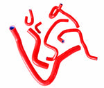 GPI Radiator Hose FOR Honda Accord SIR/SIR-T CF4 F20B 1997-2001 1998 1999/ Torneo Euro-R CL1 2000-2002  2000 2001 2002